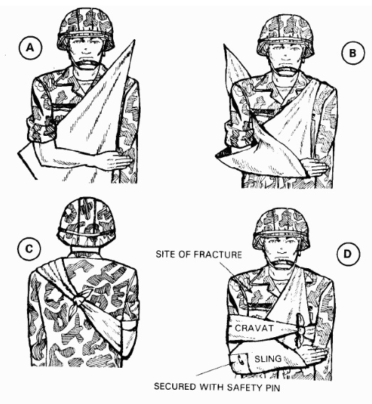 Cravat Sling – Prepper-Resources.com – The Ultimate Prepper ...